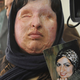 Illustration for article titled Iranian Woman Blinded By Acid Saves Attacker From Eye For An Eye